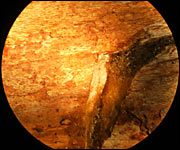 A bone under a microscope