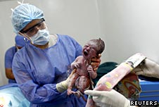New born baby