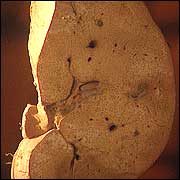 Healthy liver
