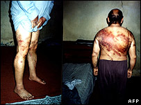 جسمانی تشدد