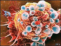 Célula cancerígena