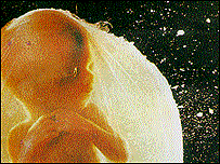 Embryo