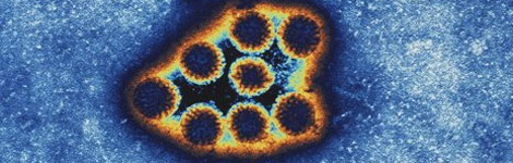 A retrovirus