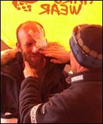 Charlie Martell is seen to by a medic