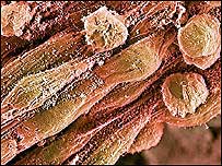Stem cells c/o BBC Science Photo Library