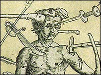 The Adventures of Wound Man and Shirley