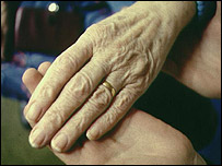 An arthritic hand
